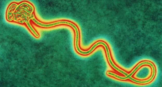 Public Health: Ebola surveillance and contingency planning